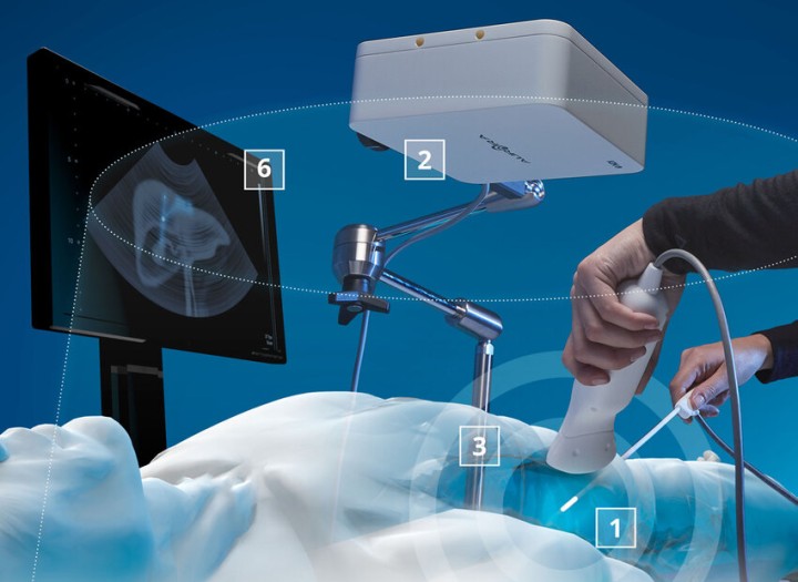NDI Aurora & 3D Guidance Electromagnetic Navigation