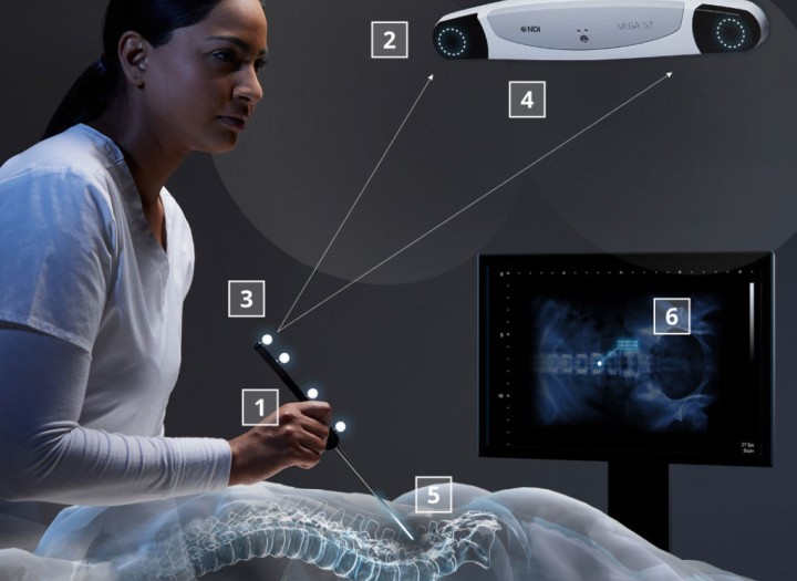 NDI Polaris Optical Navigation